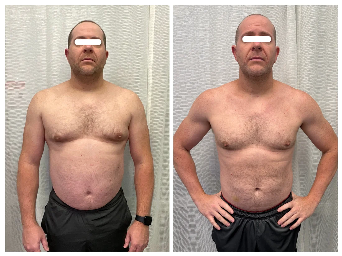 Medical weight loss before and after at Drop of Paradise med spa, El Cerrito CA — individual results vary
